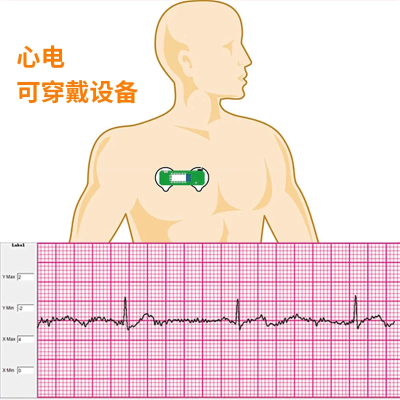 BMD101 ECG Electrocardiogram S - Ecg Patch Monitor のレビューと価格